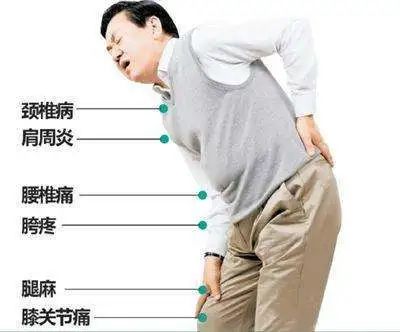 科普——关于颈肩腰腿痛
